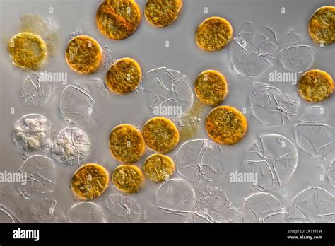  Peridinium: Een microscopisch zwemmen en licht vasthouden wonder met flagellen!