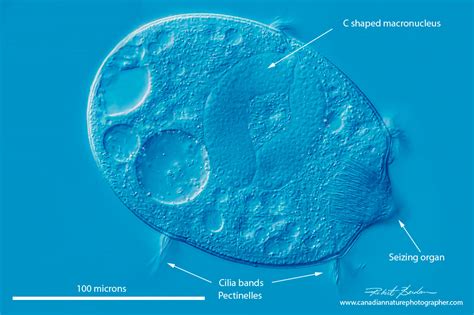  Didinium! Een Kleine Roofdier van het Zoete Water dat Zich Met Andere Ciliaten Voedt