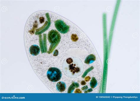 Frontonia! Een microscopische verschijning met een levensstijl vol complexe bewegingen en een fascinerende manier van voedingsopname.