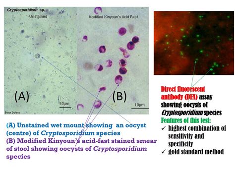  Jouw Parasiet Met de Krachtige Sporen: Ontdek de Wonderbaarlijke Wereld van de Cryptosporidium!